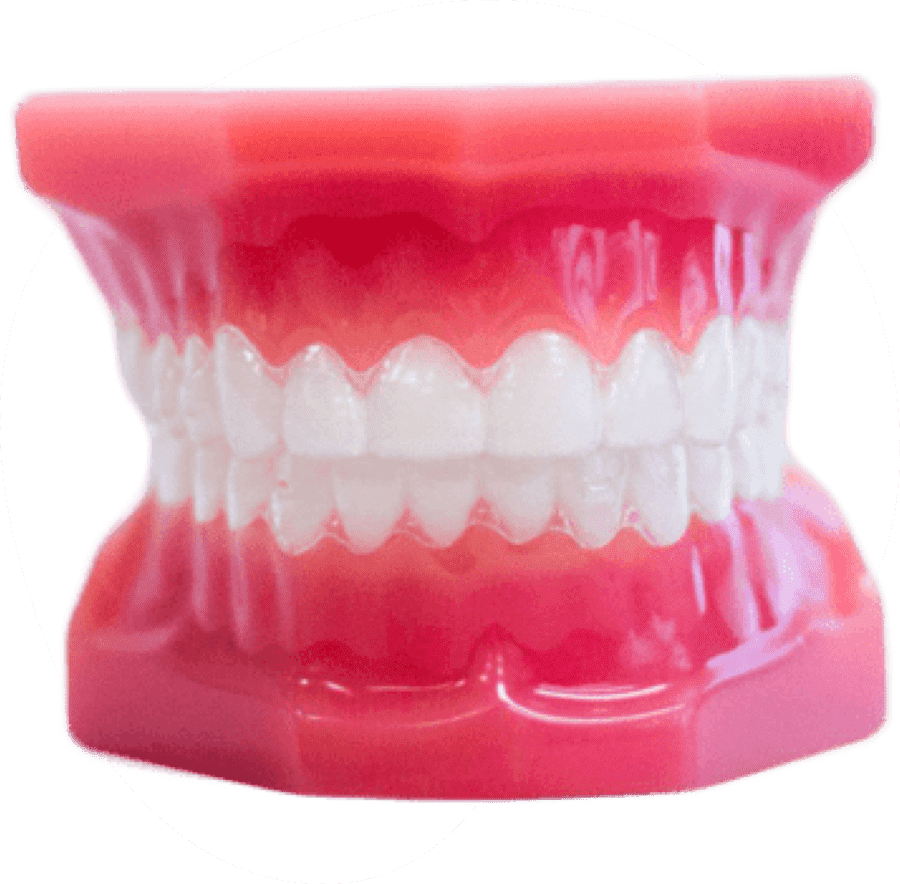 clear aligners on plastic model